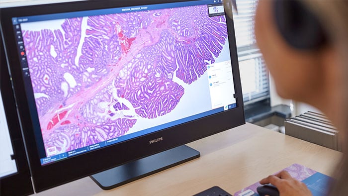 Digital pathology