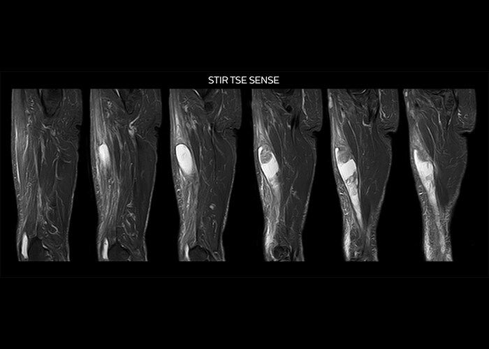 clinical cases tab1 image