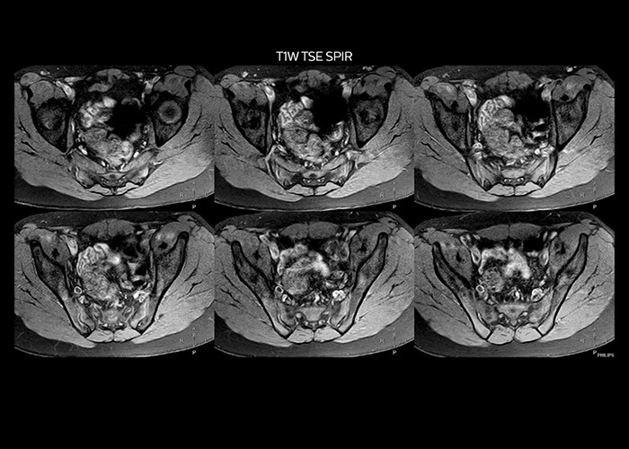 clinical cases tab2 image