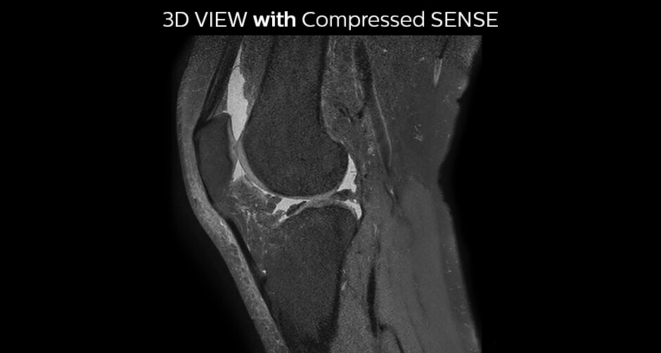 3DVIEW PD SPAIR knee Compressed SENSE factor10 sag