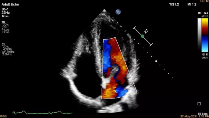 Compact Ultrasound System 5500CV