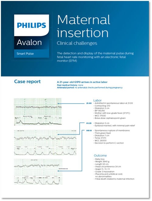 Maternal insertion PDF thumbnail