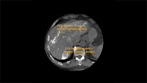 assess clinical image phase