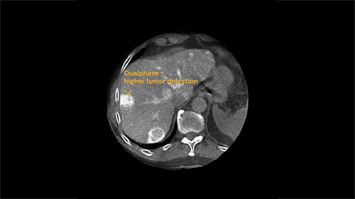 assess clinical image phase