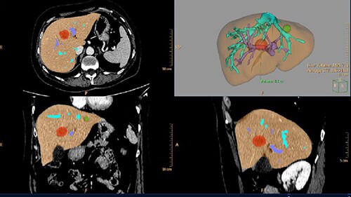 full liver assesment LM