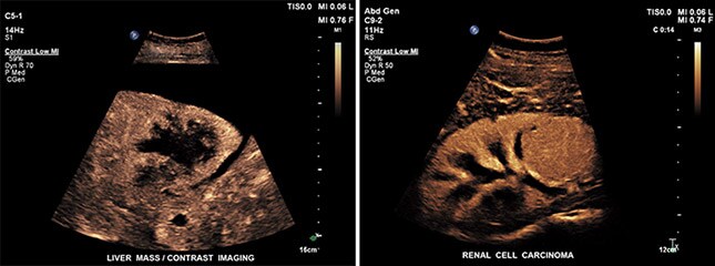 percunav imaging