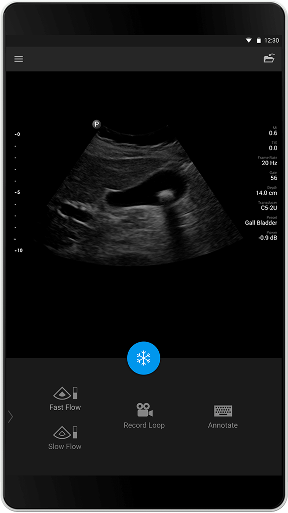 Gallbladder C5-2