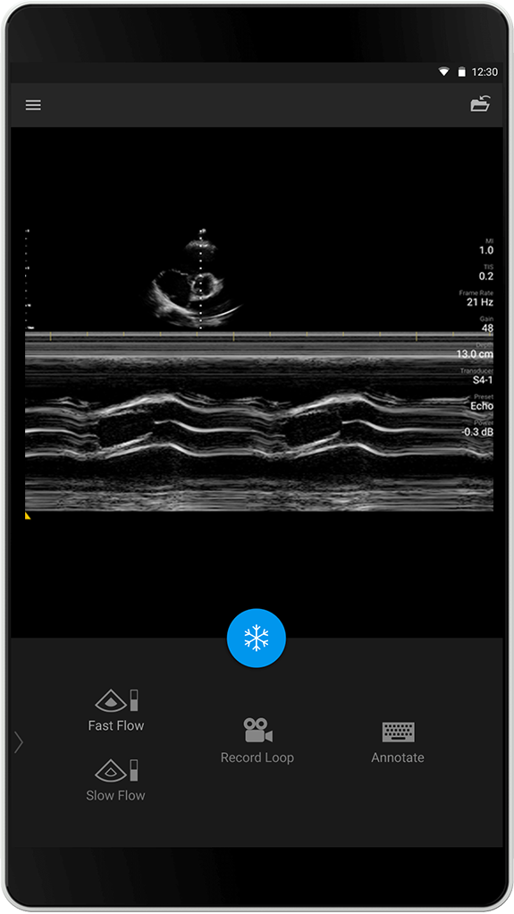 Echo exam S4-1