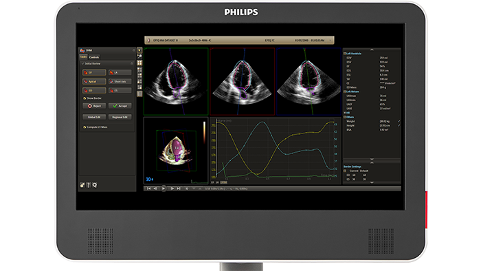 Dynamic Heart Model