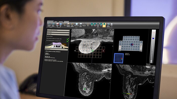 Advanced breast image analysis